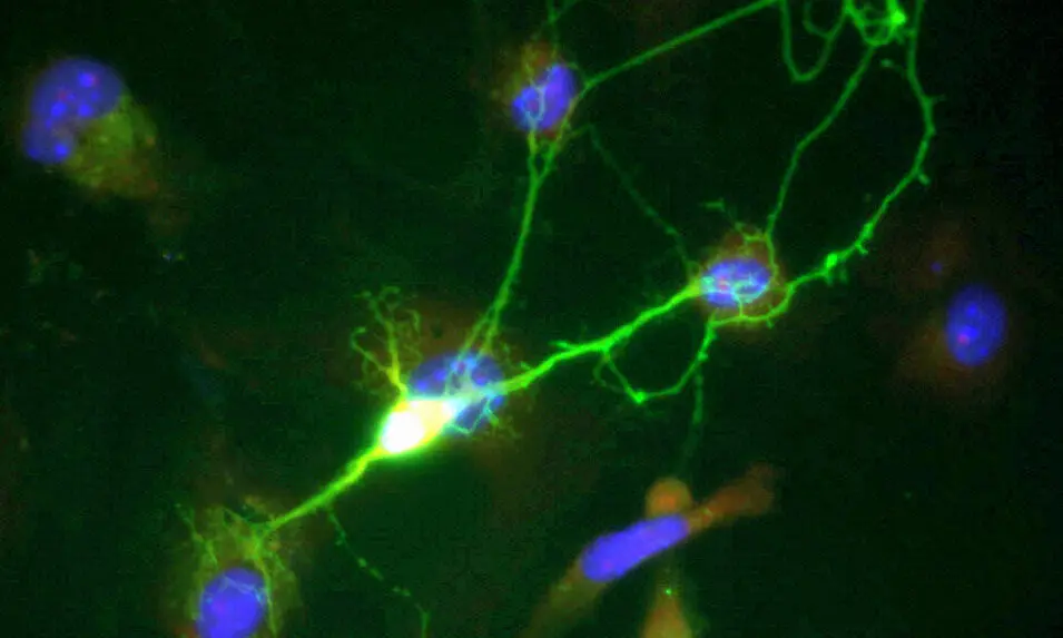 Nanotehnologie urmărește proteinele în neuronii vii pentru a accelera descoperirea de medicamente neurodegenerative